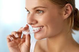 How Clear Orthodontic Braces Make Straightening Teeth Easy and Invisible