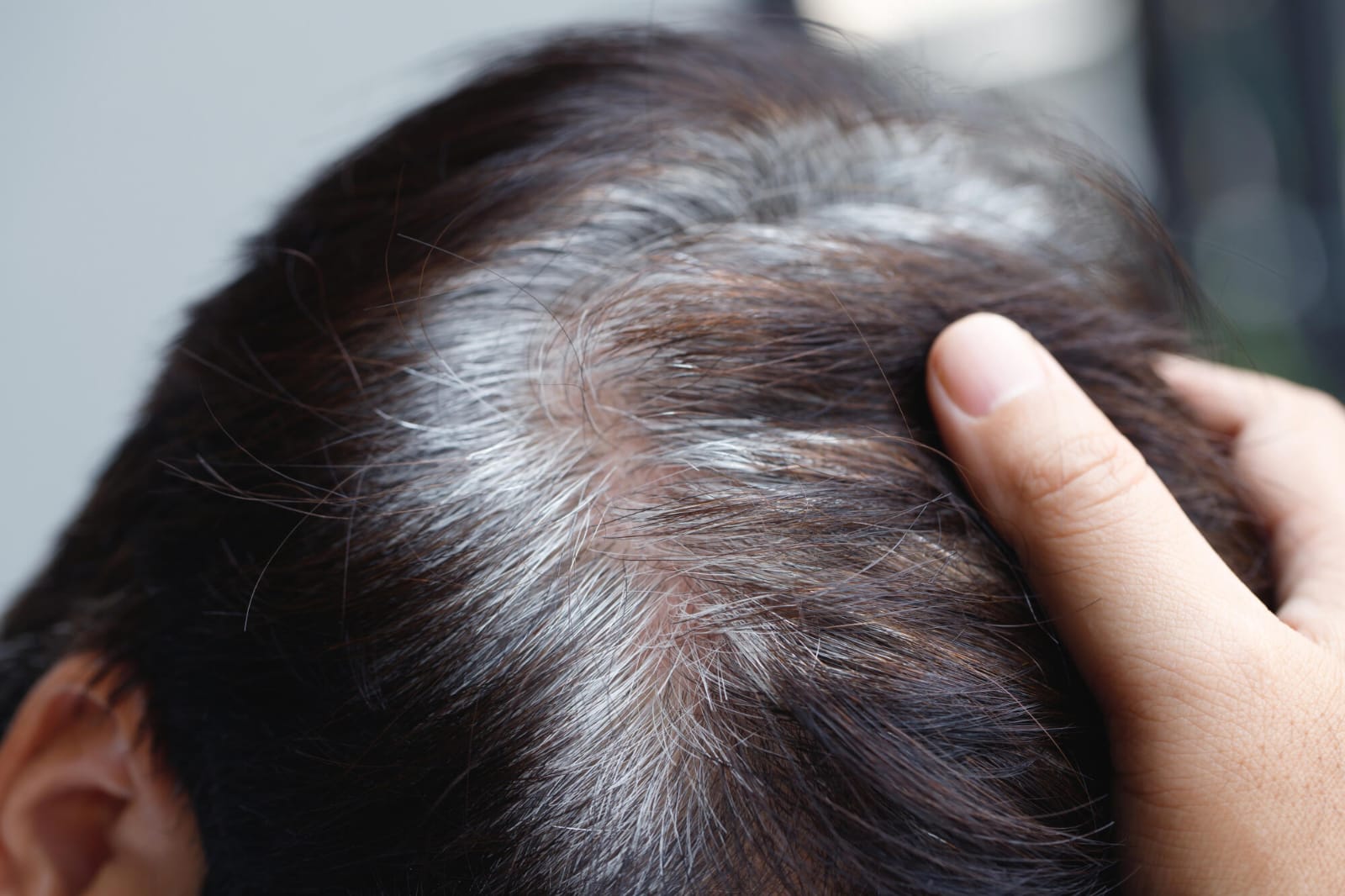 4 Common Hair Changes People Experience with Age